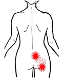 pain_in_lower_back_from_Quadratus_lumborum